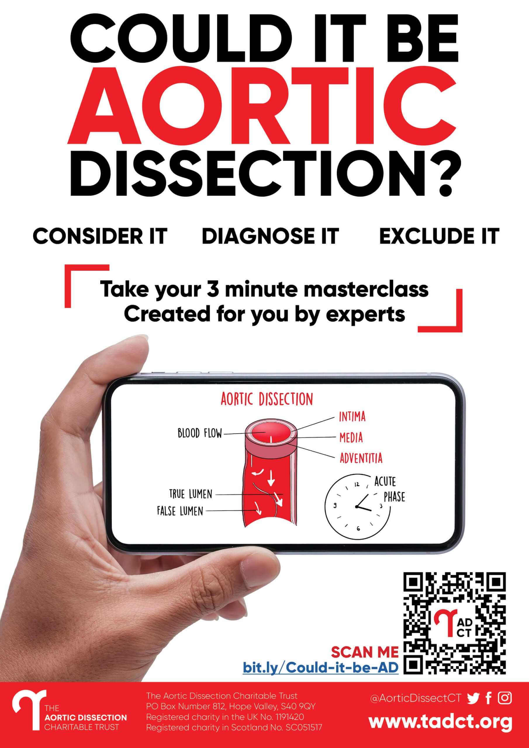 Could it be aortic dissection poster