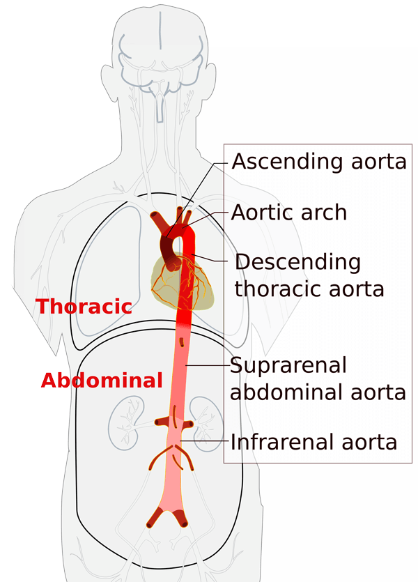 Diagram showing the sections of the aorta relevant to aortic dissection