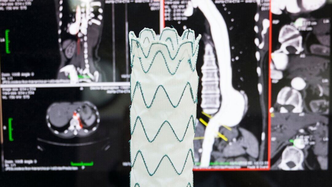 How Science and Engineering Repair Aortic Aneurysms and Dissections