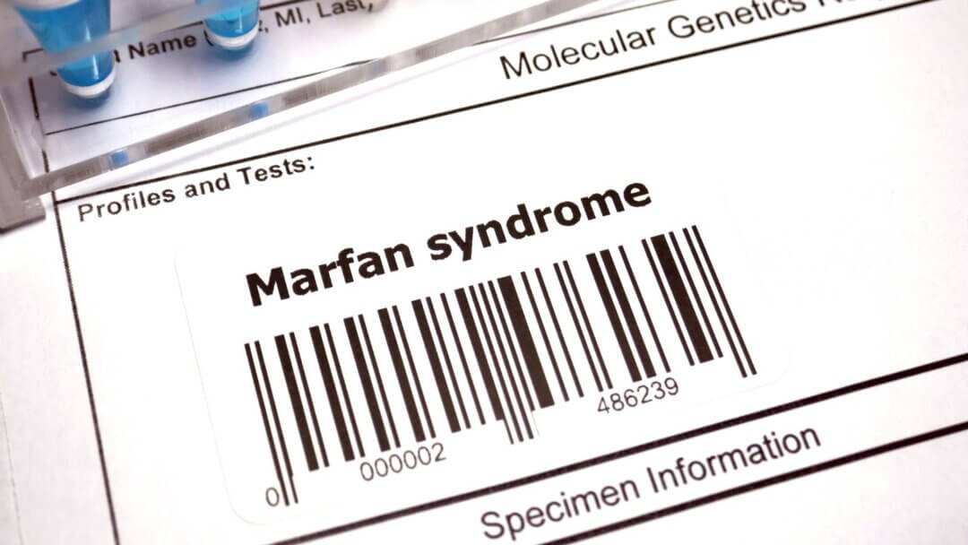 Marfan Syndrome Awareness Month 2025