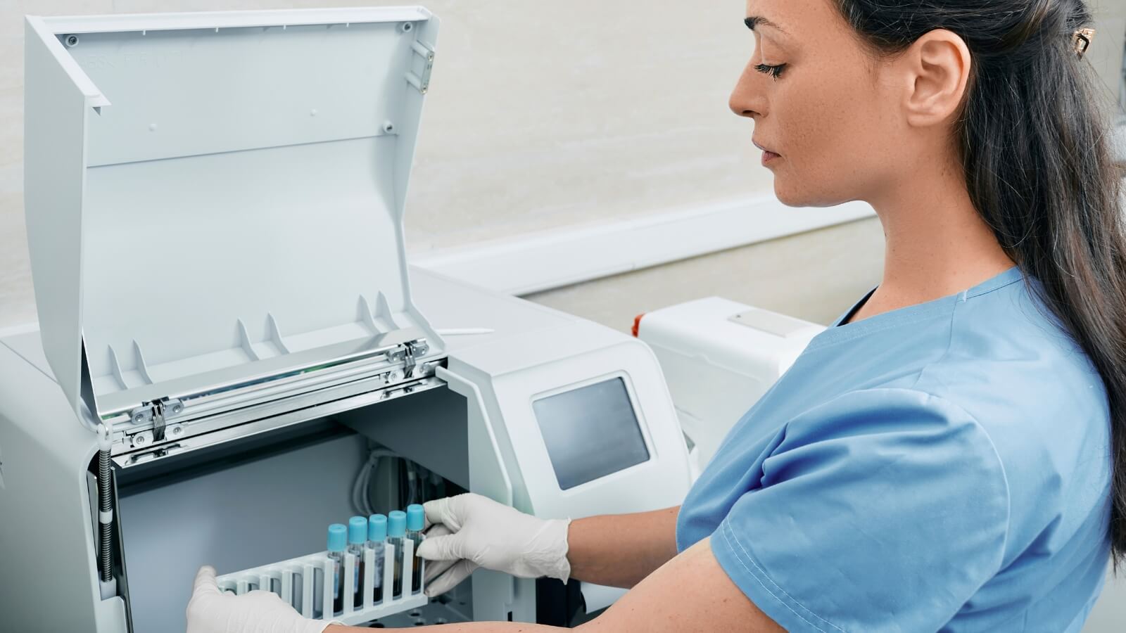 How Blood Tests Help Spot and Manage Aortic Dissection
